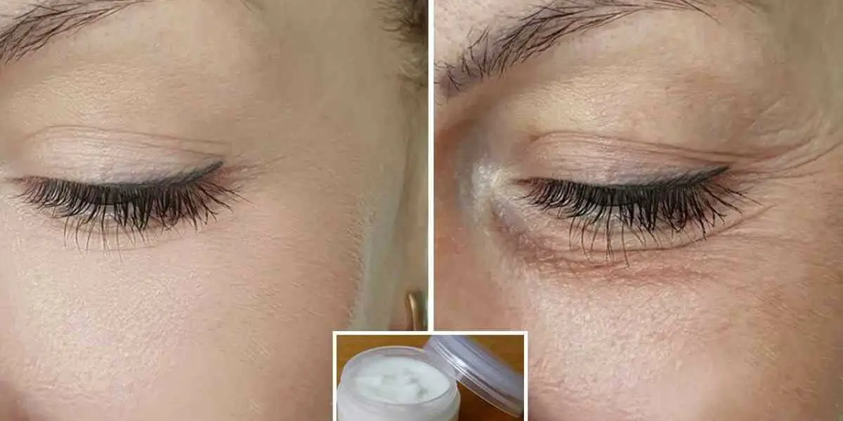 6 consejos eficaces para rejuvenecer el contorno de ojos y levantar los párpados caídos